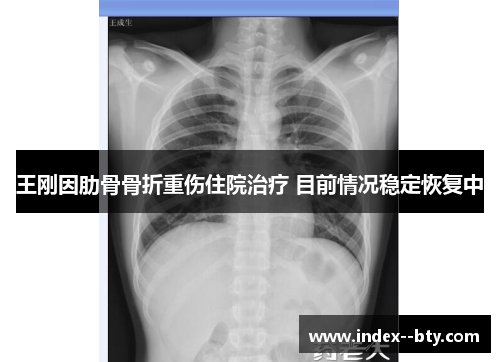 王刚因肋骨骨折重伤住院治疗 目前情况稳定恢复中